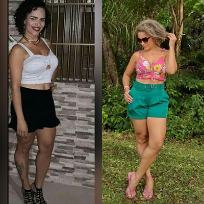 Antes-e-depois-Anne.jpg