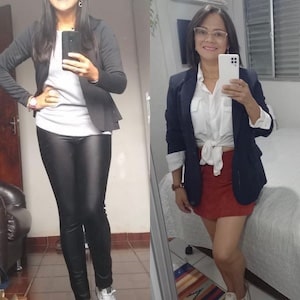 Erila_Antes-e-depois.jpg